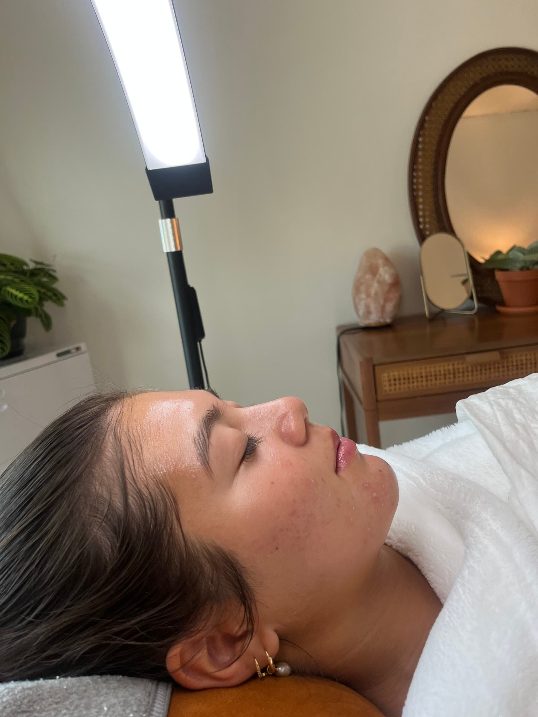 Client skin after completing the Acne Clarity Program